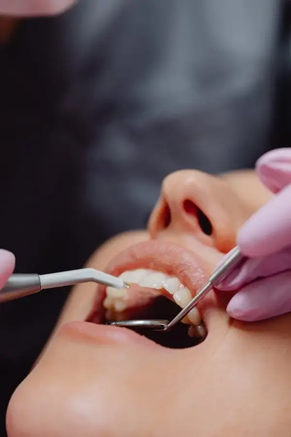 signs of a cavity between teeth everything you need to know2
