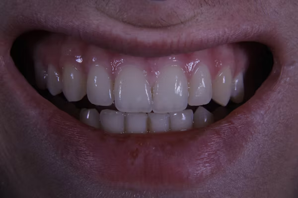 image of a person's teeth