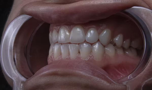 a close-up shot of a person's teeth